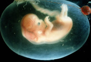 IVF Embryo